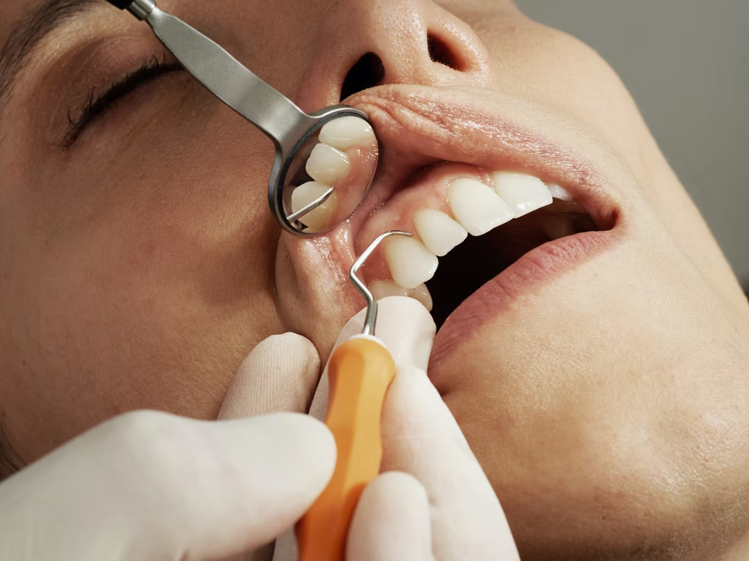 Dental Service